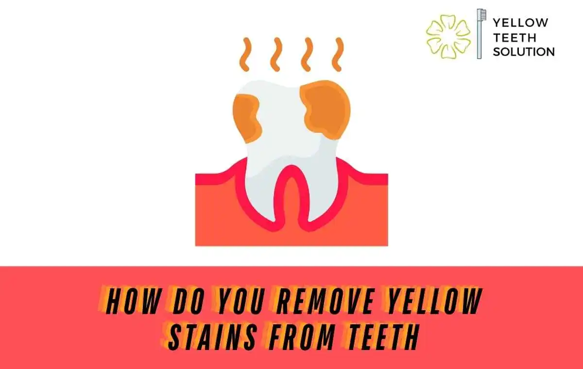 How do you remove yellow stains from teeth