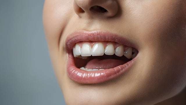 Natural Ways to Whiten Your Teeth