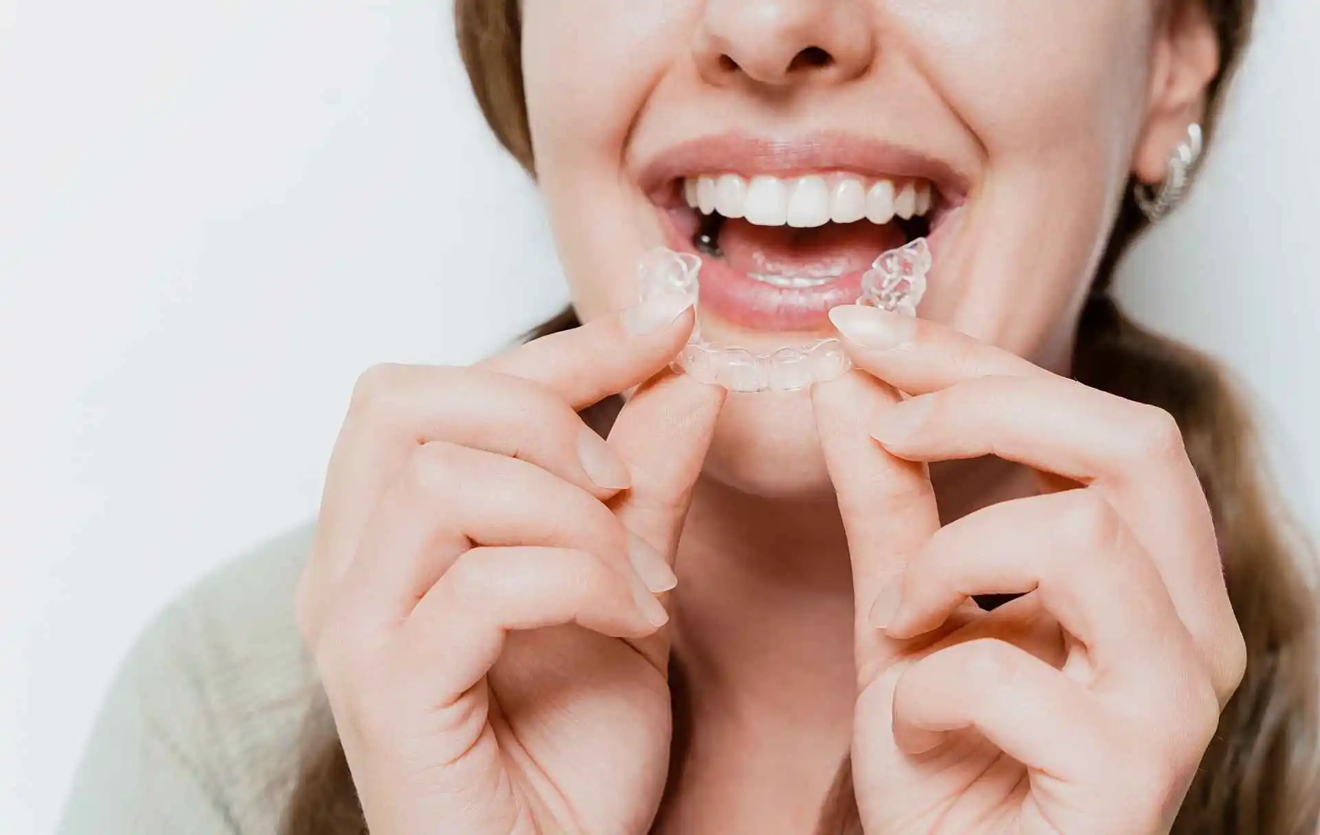 Teeth straightening at home