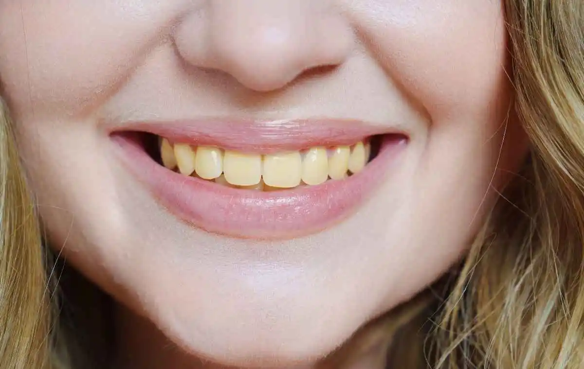 What makes teeth yellow