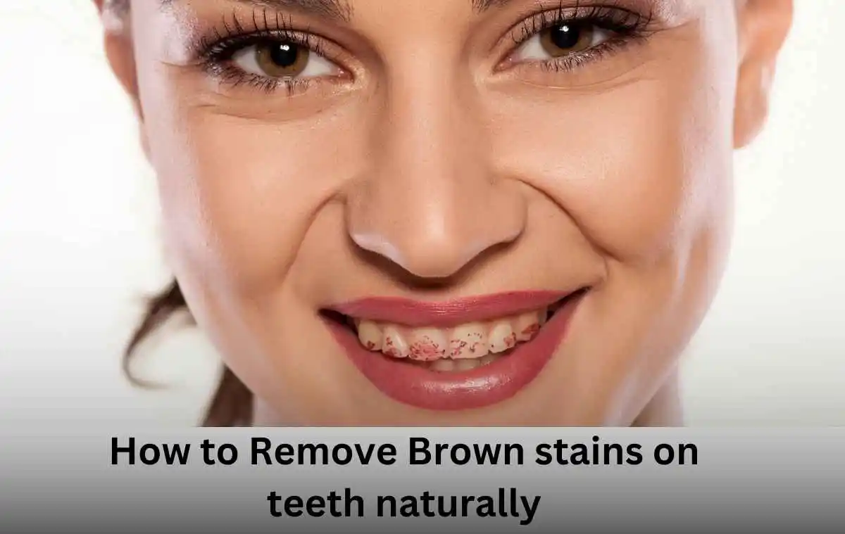 How to Remove Brown stains on teeth naturally