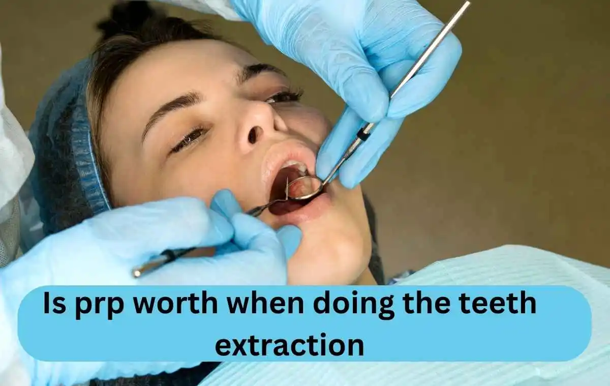 Is prp worth when doing the teeth extraction