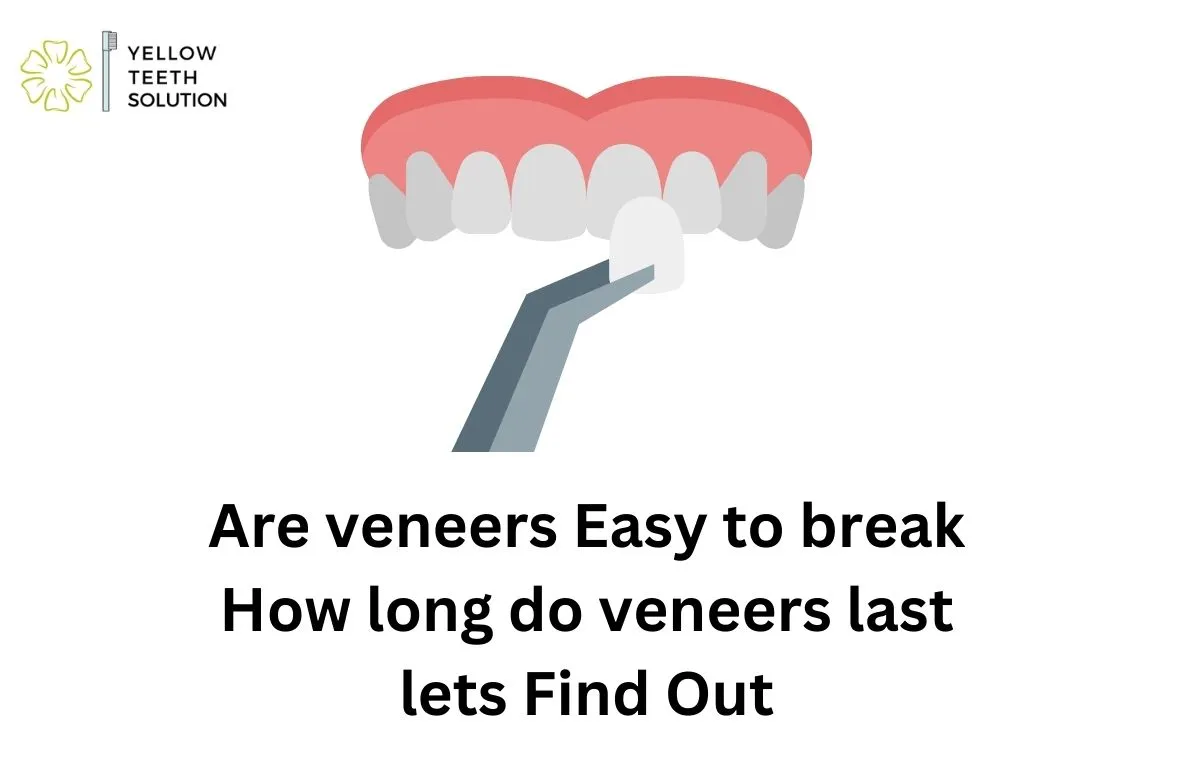 Are veneers Easy to break