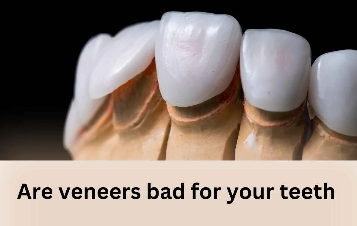 Are veneers bad for your teeth