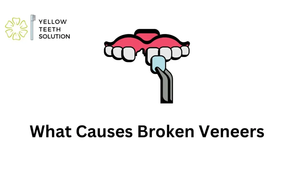 What Causes Broken Veneers